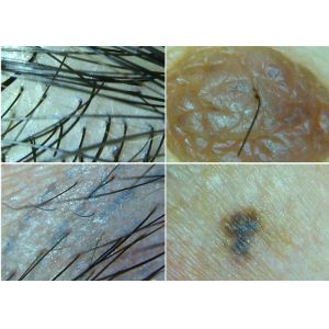 Handheld Skin And Hair Magnifier Dermatoscope Digital Skin Analyzer with 50~1000