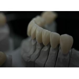 Dental Solid Zirconia Crown Ombining Outstanding Strength And Natural Aesthetics