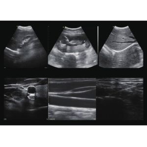 Buy cheap Doppler Ultrasound Equipment Hand held Doppler Machine 128 Elements 90~200mm Depth 235g Weight Wifi Connection from wholesalers