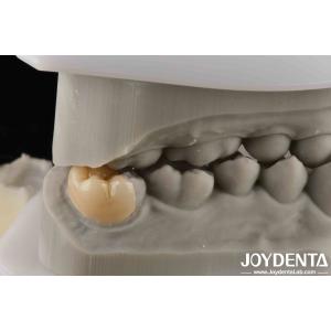 Buy cheap High Strength Emax Good Transparency Emax Inlay Onlay For Transparent Performanc product