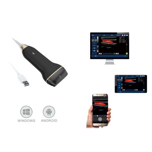 Quality Compact Digital Portable Mobile Ultrasound Scanner Supported Andriod And Window for sale