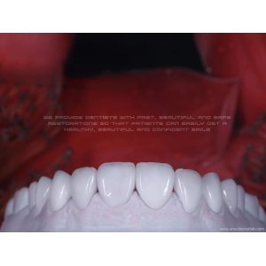 Buy cheap Zirconia Ceramic Veneer Natural White product