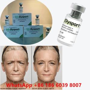 Buy cheap Botulinum Toxin 100 Units BTX Injection Type A Cosmetic Use from wholesalers