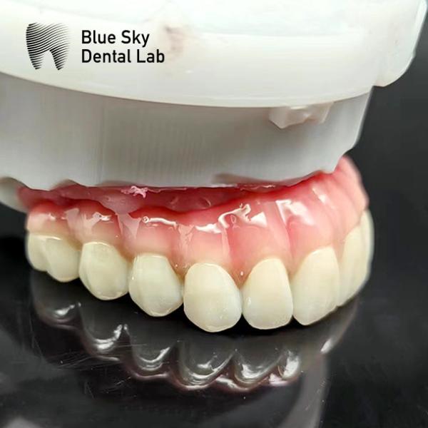 Quality Customized Full Mouth Implant Case Universal Compatibility for sale