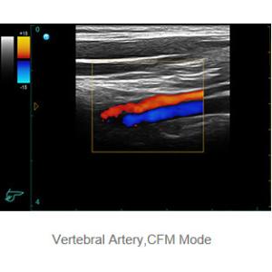 Buy cheap Ipad Ultrasonic Diagnostic Device Portable Ultrasound Scanner with 500G Image Storage from wholesalers
