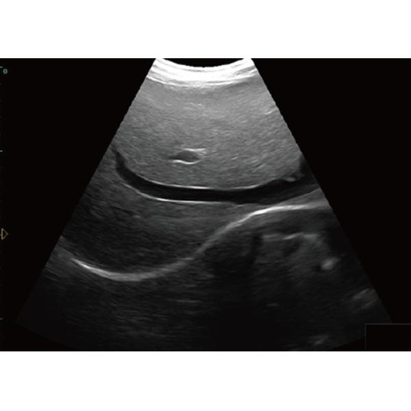 Quality Notebook Ultrasound Scanner Easy to Carry Laptop Ultrasound Scanner With Touch Screen Control Panel for sale