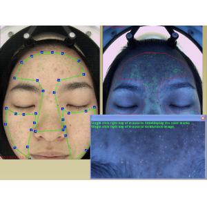 Buy cheap Moisture Analyzer Face Camera 20Mega Pixels FCC Certificate from wholesalers