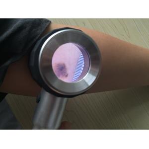 Buy cheap Skin And Hair Analysis Video Dermatoscope Home Use Silver Metal Optical Glass Lens 10 Times Magnifier from wholesalers