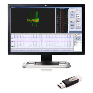 Buy cheap 24 Hours ECG Holter with Holter ECG Analysis Software iTengo (replace DMS/DL900) from wholesalers