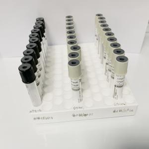 Buy cheap Sterile Red Top Blood Collection Tubes Clot Activator Tube CE And ISO Approved from wholesalers
