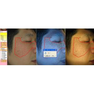 Buy cheap UV RGB Light Facial Skin Analysis BS-3200 Skin Analyzer from wholesalers