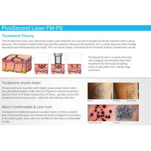 sself-product Newest 600ps Painless Shorter Session Removal Best Picosecond