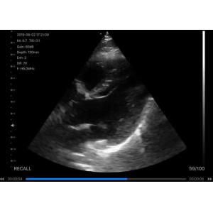 Buy cheap Digital Wireless Handheld Ultrasound Scanner from wholesalers