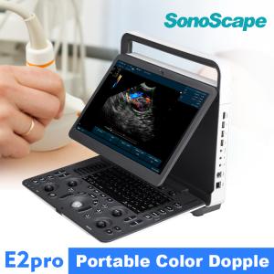 Buy cheap SonoScape E2pro Color Doppler Echo Machine Ultrasound Machine USG with TDI CW PW Function from wholesalers