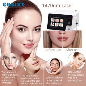 China Laser 1470nm EVLT Varicose Removal Red Blood Veins Reducing Laser Machine on sale
