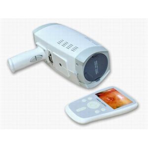 High-Resolution Imaging Digital electronic Colposcope Handheld Video Colposcope