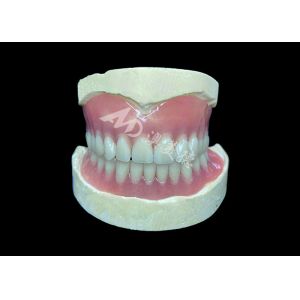 Buy cheap Easy-to-Clean Custom Cast Partial Dentures Ideal for Restoring Chewing Ability and Smiles from wholesalers