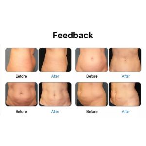 Buy cheap Fat burning cellulite weight loss Cold laser green RED Light 532nm 635nm Wavelength Body Shape 6D slimming machine lipo from wholesalers