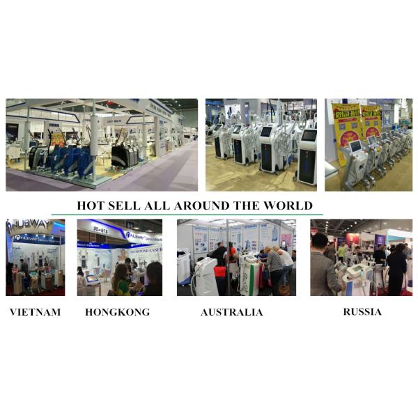 2018 trend product 1064 nm 532nm q switched nd yag laser for melasma