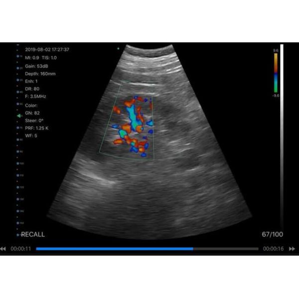 Support Printing Reports Handheld Ultrasound Scanner 13 Application 6 Language App Free IOS Android Windows Compatible 2