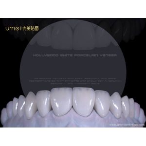 Buy cheap Refractory Veneers from wholesalers