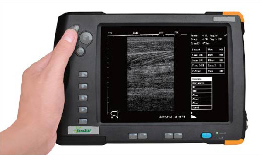 Quality Palm Ultrasound ScannerSU-V5(ultrasonic,black white,Imaging System) for sale