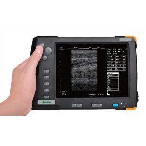 Buy cheap Palm Ultrasound ScannerSU-V5(ultrasonic,black white,Imaging System) from wholesalers