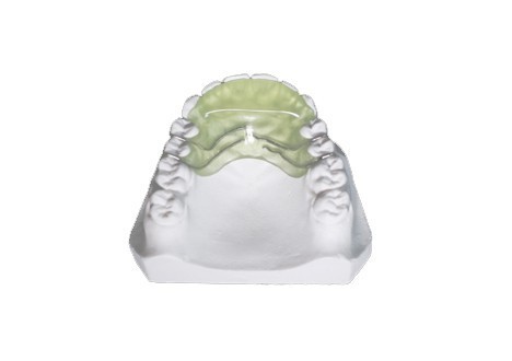 Buy cheap Customized Orthodontic Functional Appliance Removable Flat Guide Plane from wholesalers