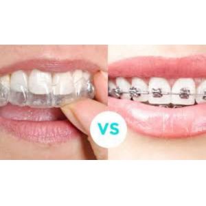 PETG Thermoform Plastic Sheet 0.5mm PETG Clear Plastic Sheet For Invisalign