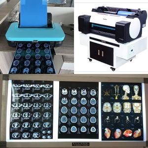 Buy cheap 210 Microns Blue Inkjet X Ray Film MRI Image Output With High Printing Quality For Black White from wholesalers