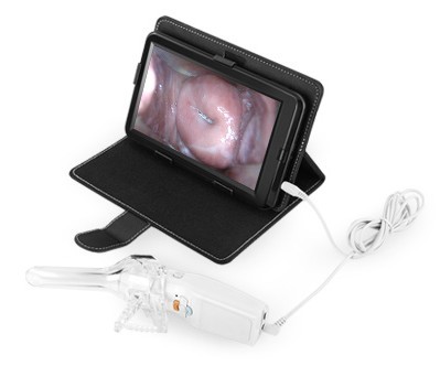 Quality Self - Inspection Handheld Digital Electronic Colposcope Transvaginal Detector With Dimension of 126×40×34mm for sale