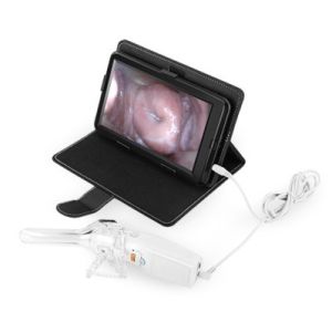 Buy cheap Self - Inspection Handheld Digital Electronic Colposcope Transvaginal Detector With Dimension of 126×40×34mm from wholesalers