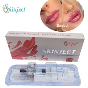 Injectable Skinject Deep HA Dermal 2ml Lips Fillers Cheek Chin Nasolabial Fold