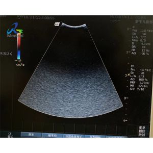 Buy cheap GE 8C-RS Ultrasound Probe Repair Service Acoustic Lens Replacement from wholesalers