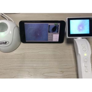 Digital Magnicication Video Dermatoscope Skin and Scalp Analyzer with 50, 200