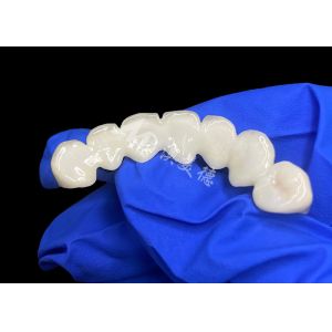 High Translucency Lava Zirconia Dental Bridge Seamless Blend With Natural Teeth