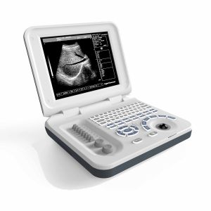 OEM ODM Portable Ultrasound Machines For Home Use