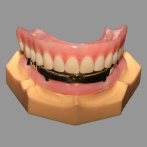 Buy cheap Full Acrylic Denture All On X Dental Implants AOX Class 4 With Locator Attachment from wholesalers