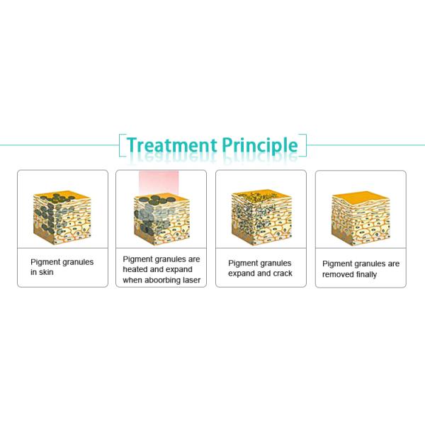 2018 trend product 1064 nm 532nm q switched nd yag laser for melasma