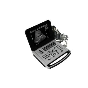 Buy cheap Notebook Black And White Ultrasound Scanner for Cardiology product