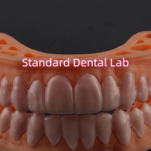 OEM ODM Pop On Veneers Custom Made Veneers Snap On Smile