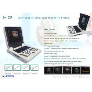ISO Basic Level Portable USG Machine Digital Color Doppler Ultrasound System