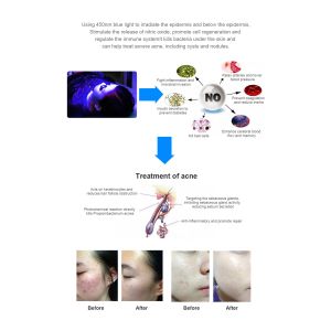 Buy cheap Muscle Message 635nm 660nm 850nm LED Red Light Therapy Beds For Chiropractic Use from wholesalers