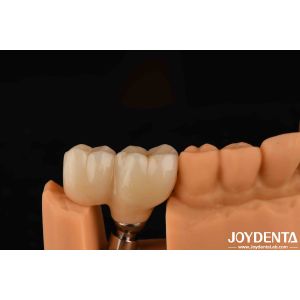 Buy cheap V Shaped Thread Type Finished Abutments Compatibility With All Major Implant Systems from wholesalers