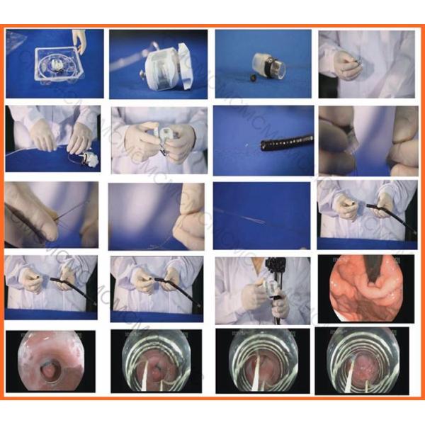 Endoscopic Rubber Band Ligator 10mm Endoscopy Accessory