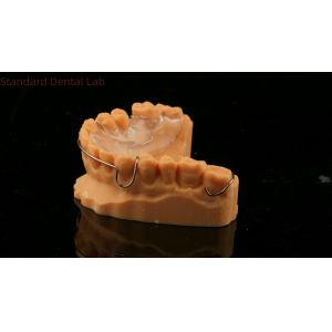 Buy cheap Perfect Fit Germany Ortho Teeth Halley Retainer for Esthetics and Adjustability Clear Shade SDL Dental Lab from wholesalers