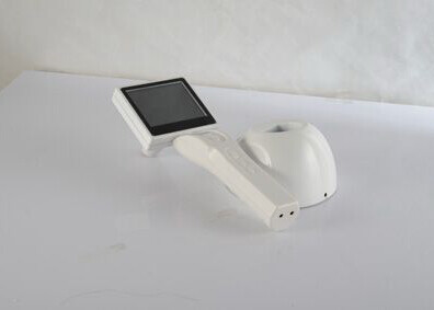 Buy cheap Skin / Hair Medical Digital Scope Mini Electronic Colposcope With USB / AV Output from wholesalers