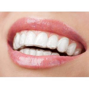 Easy To Clean Reusable TPU Dental Sheet Orthodontics Material