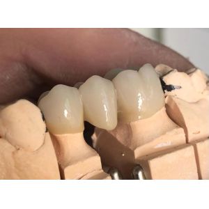 Buy cheap Dental Materials 3D Pro Multilayer Zirconia Block CAD CAM 98mm System Ceramic Block for Long Bridge from wholesalers