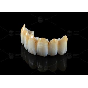 High Translucency Full Contour Zirconia Bridge Chipping Resistance Natural